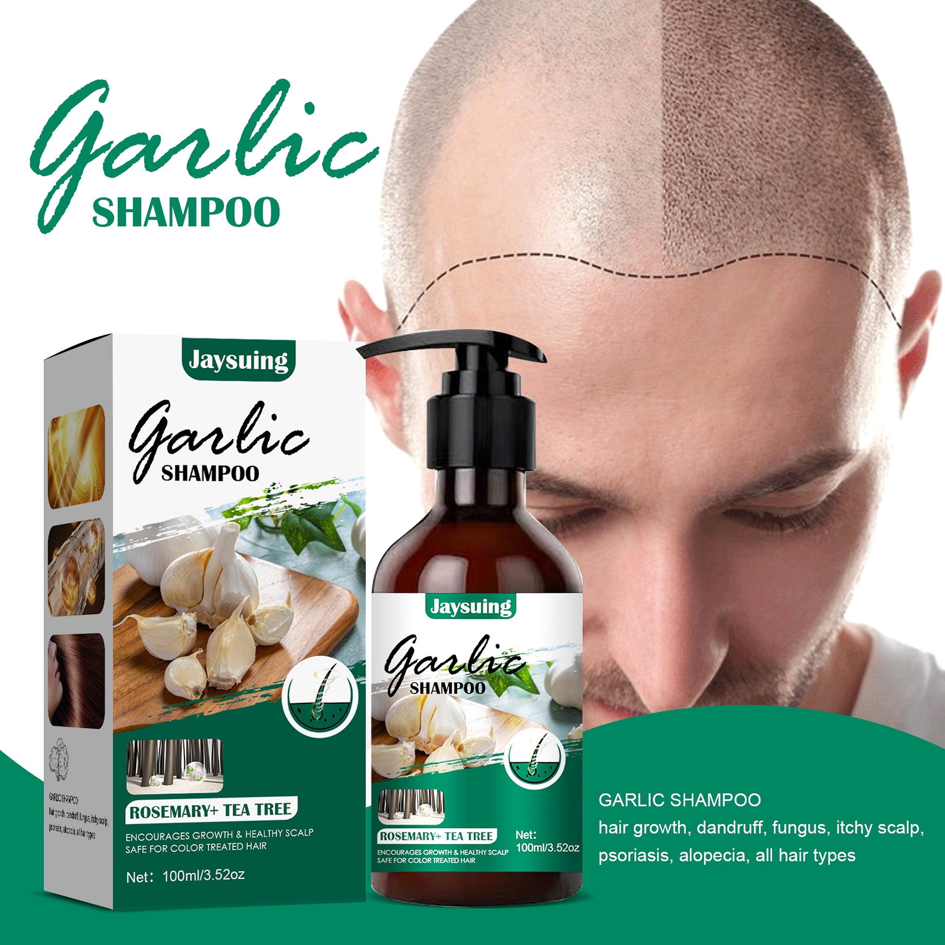 Garlic Shampoo – Botanical HairRepair Formula - enhanced image 1