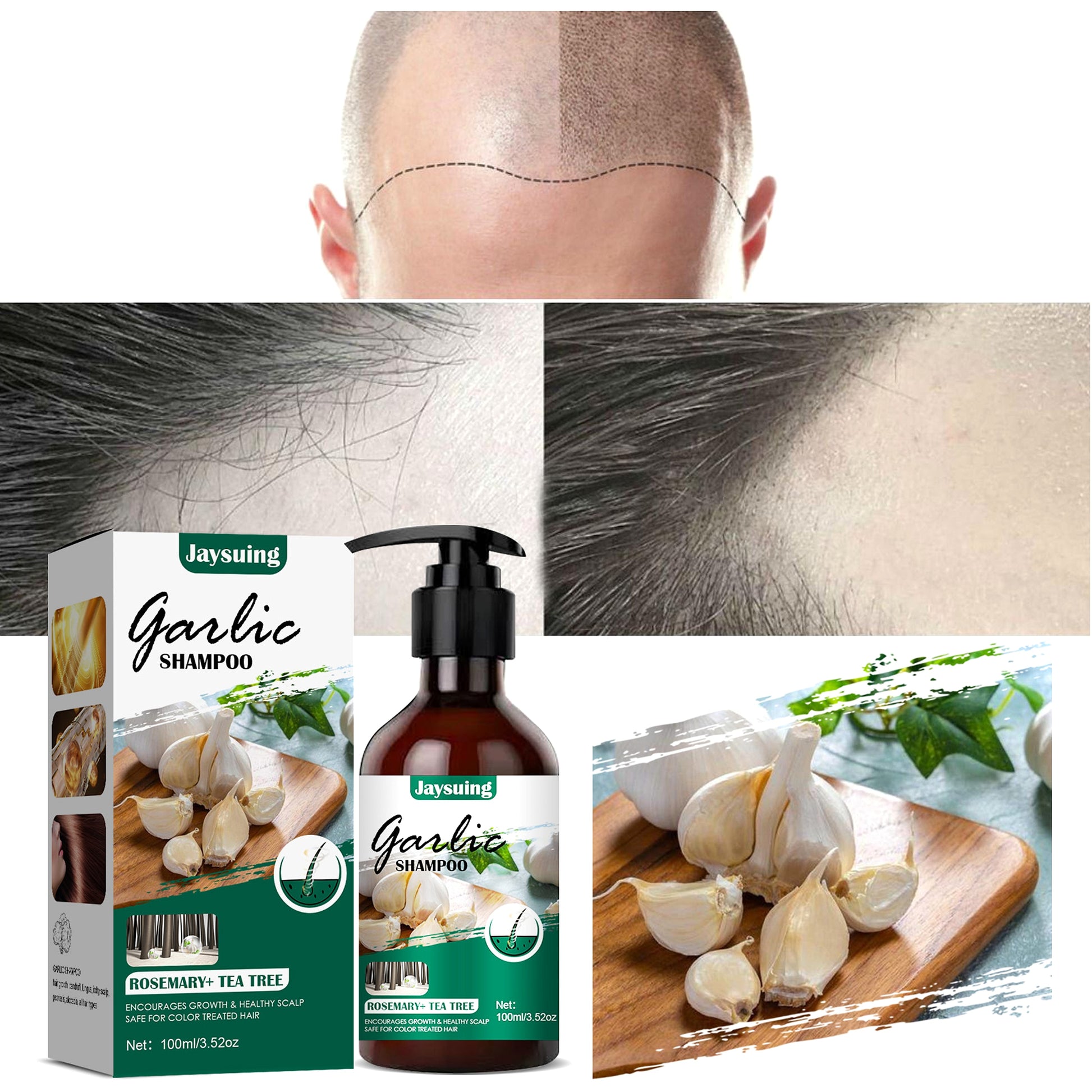 Garlic Shampoo – Botanical HairRepair Formula - enhanced image 3