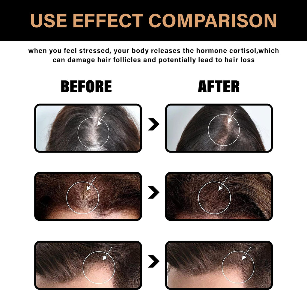 LUNOON™ Root Activating Shampoo - enhanced image 6