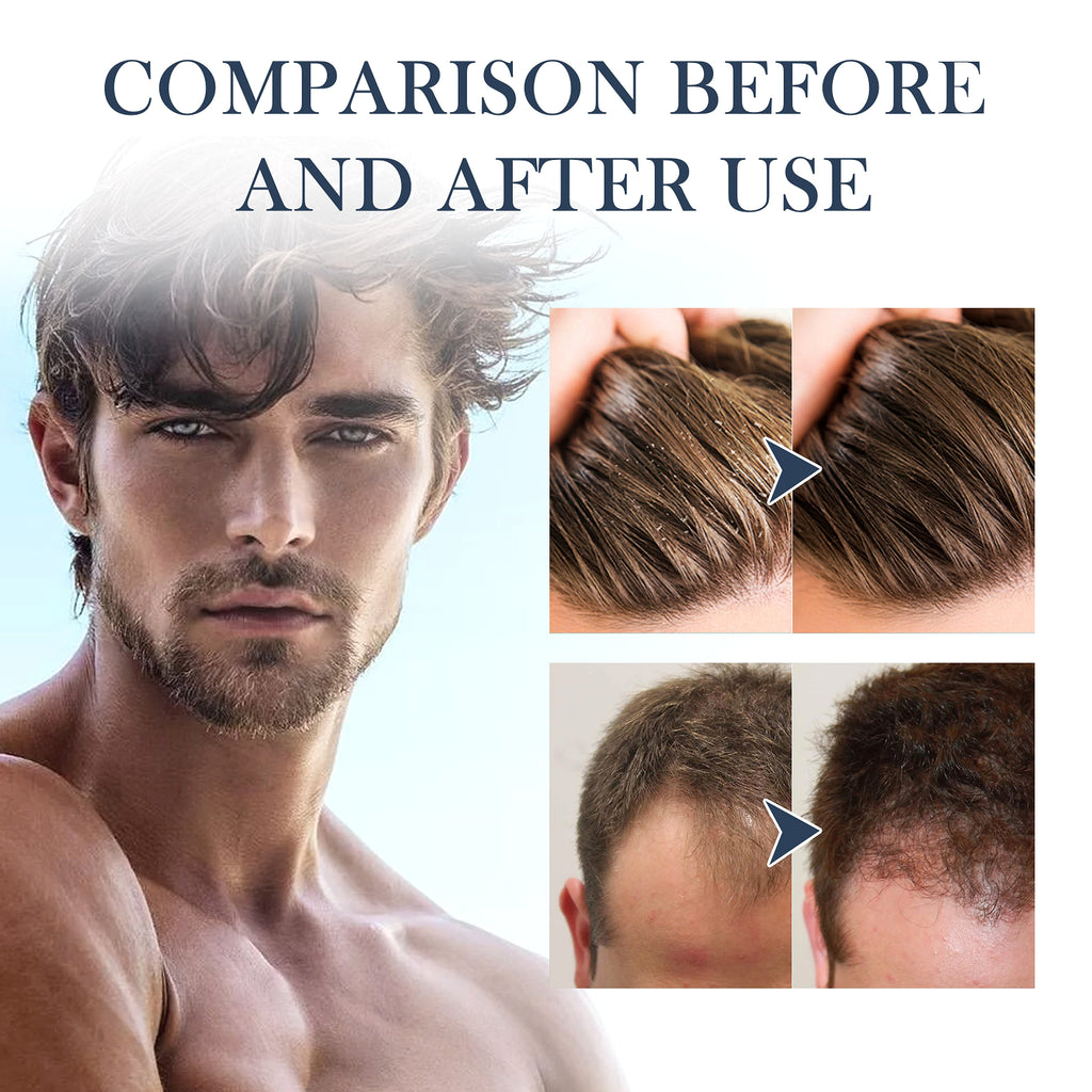 East Moon™ Hair Strengthening Shampoo – Power & Purity for Men - enhanced image 8