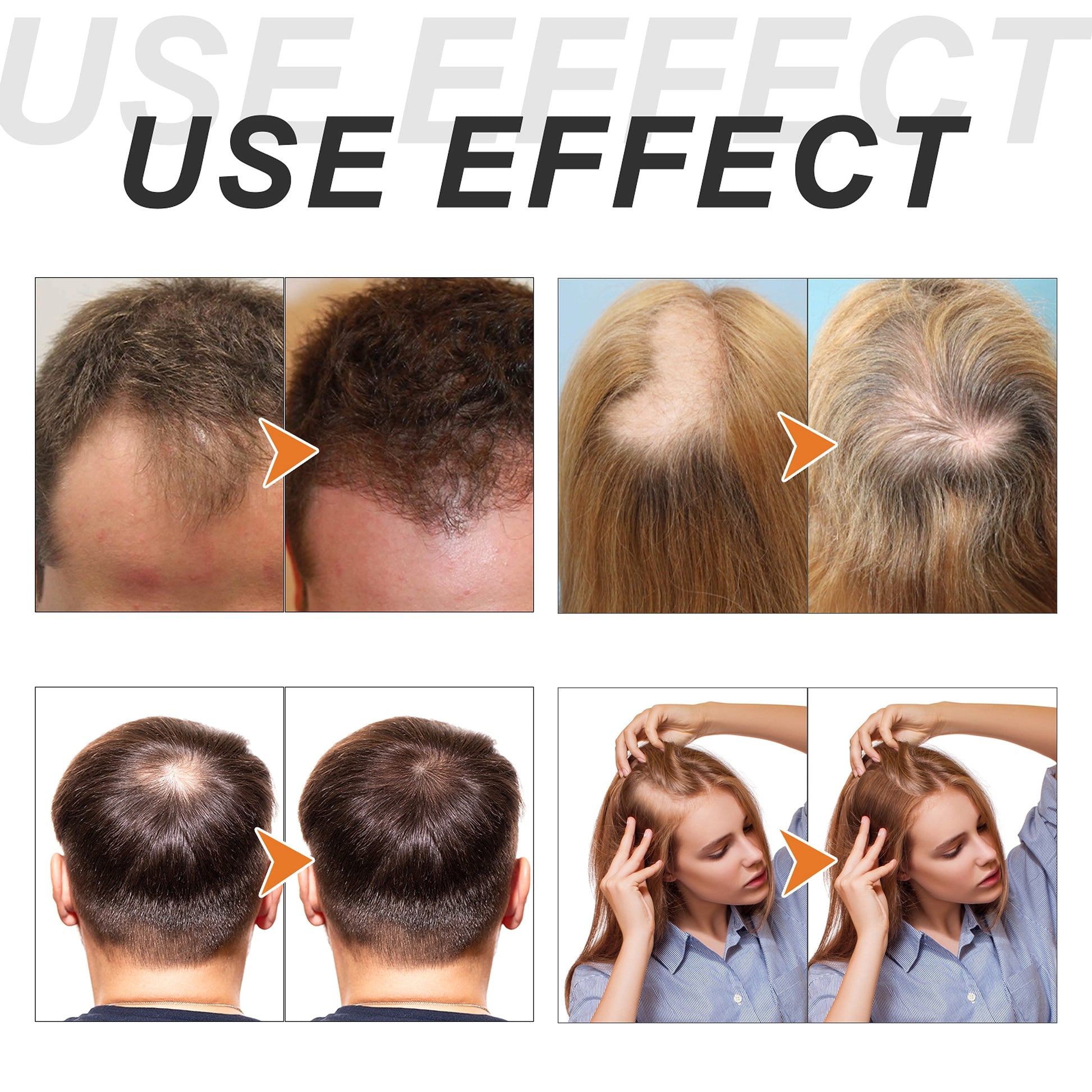 RootRenew™ Biotin & Botanical Boost Set - enhanced image 10